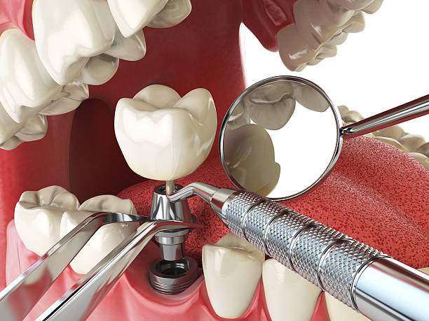 Best Emergency Cosmetic Dentistry in Coshocton, OH